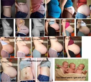 Pregnant with triplets belly 960X873 jpeg