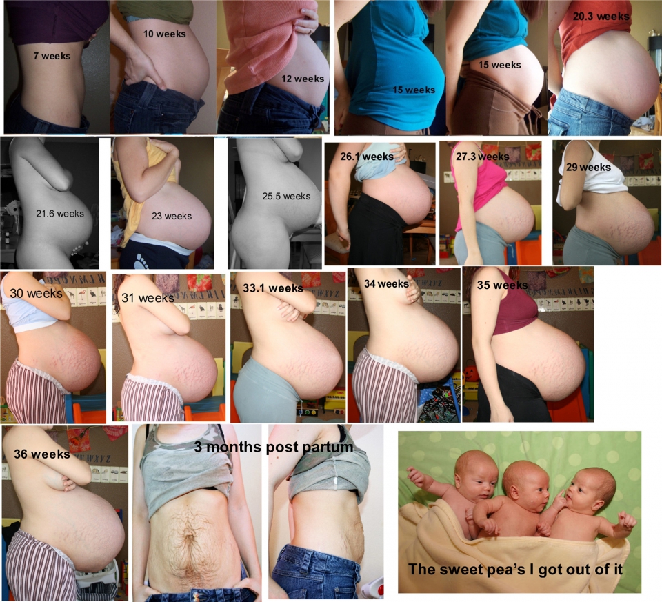 Pregnant with triplets belly full size