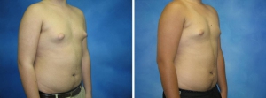 Pre puberty boy erection 960X357 jpeg