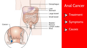 Anal cancer symptoms 800X450 jpeg