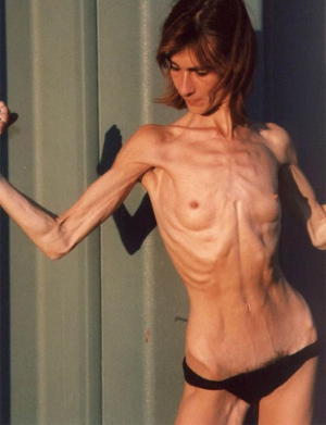 Skinny anorexic girls having sex 562X734 jpeg