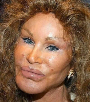 Bad plastic surgery 600X684 jpeg