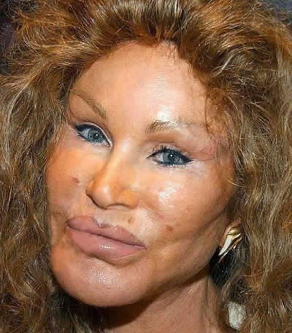 Bad plastic surgery full size