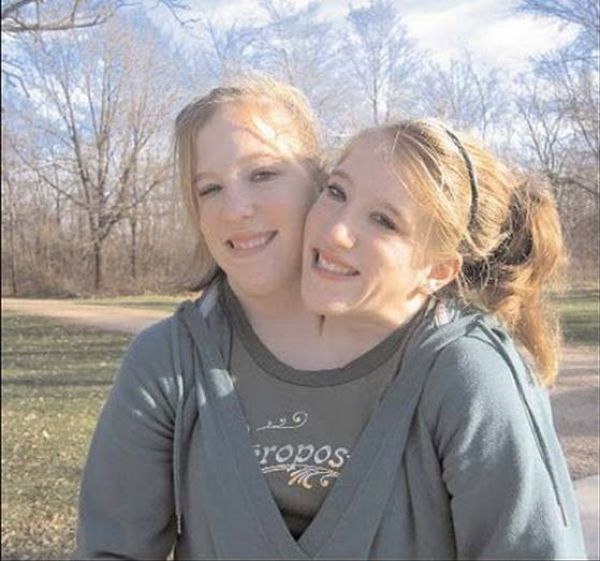 Girl with two heads abigail and brittany full size