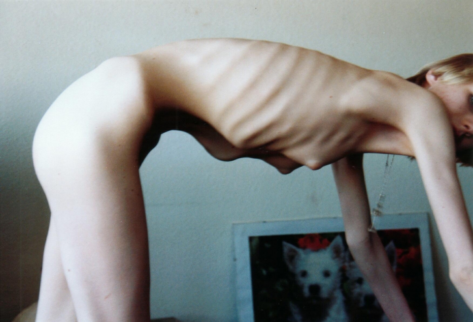 Nude anorexic girls sex full size