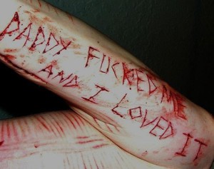Emo cuts on your wrist 599X474 jpeg