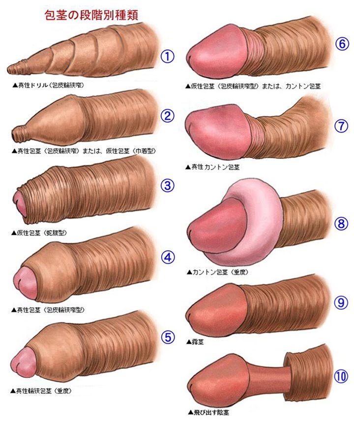 Different types of penis full size