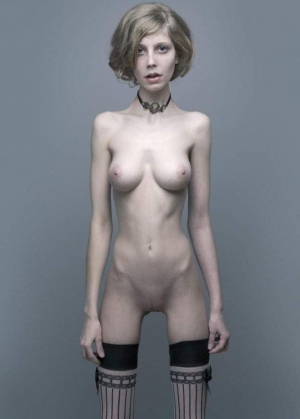 Anorexic skinny girl 682X954 jpeg