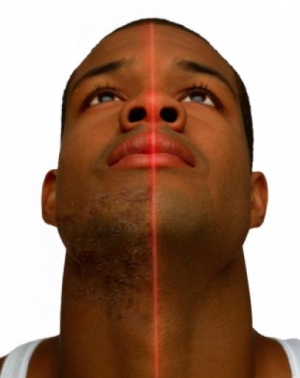 Black men with razor bumps 407X514 jpeg