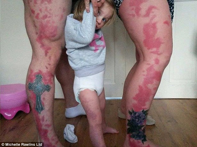 Birthmark tattoo gets parents daughters full size