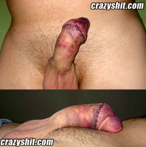 John wayne bobbitt penis cut off 466X470 jpeg