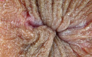 Women anus close up 960X601 jpeg