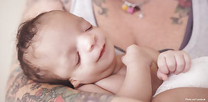 Babies with treacher collins syndrome 912X450 jpeg