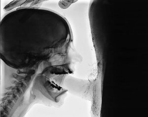 Deep throat x ray 598X478 jpeg