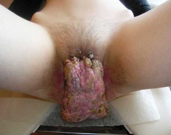 World s hairiest pussy full size