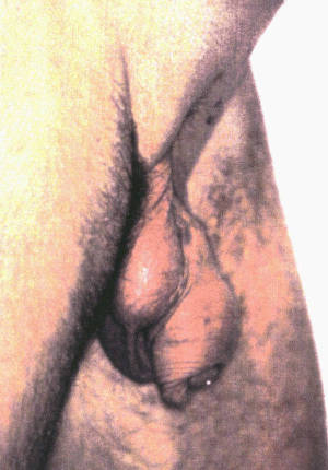 Odd penis shapes 600X860 jpeg