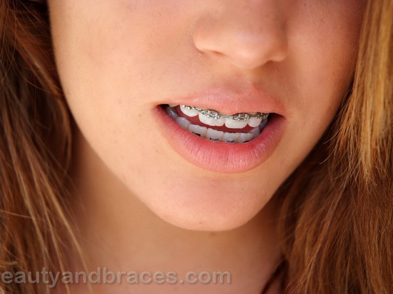 Shemale with braces porn full size