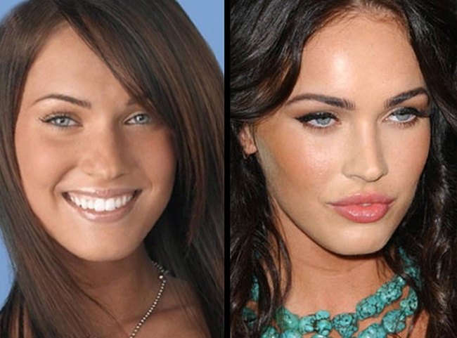 Megan fox plastic surgery before after full size