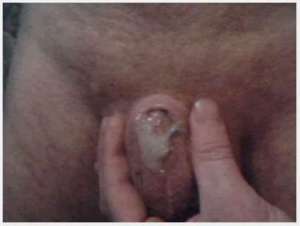 Inny micro penis cumming 550X415 jpeg