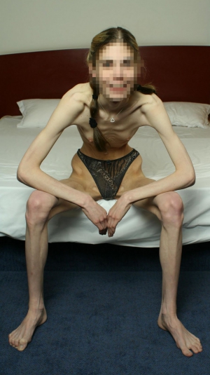Woman skinny anorexic girls 896X1600 jpeg