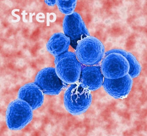 Streptococcal pharyngitis bacteria 450X416 jpeg