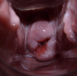 Vagina cervix 960X949 jpeg