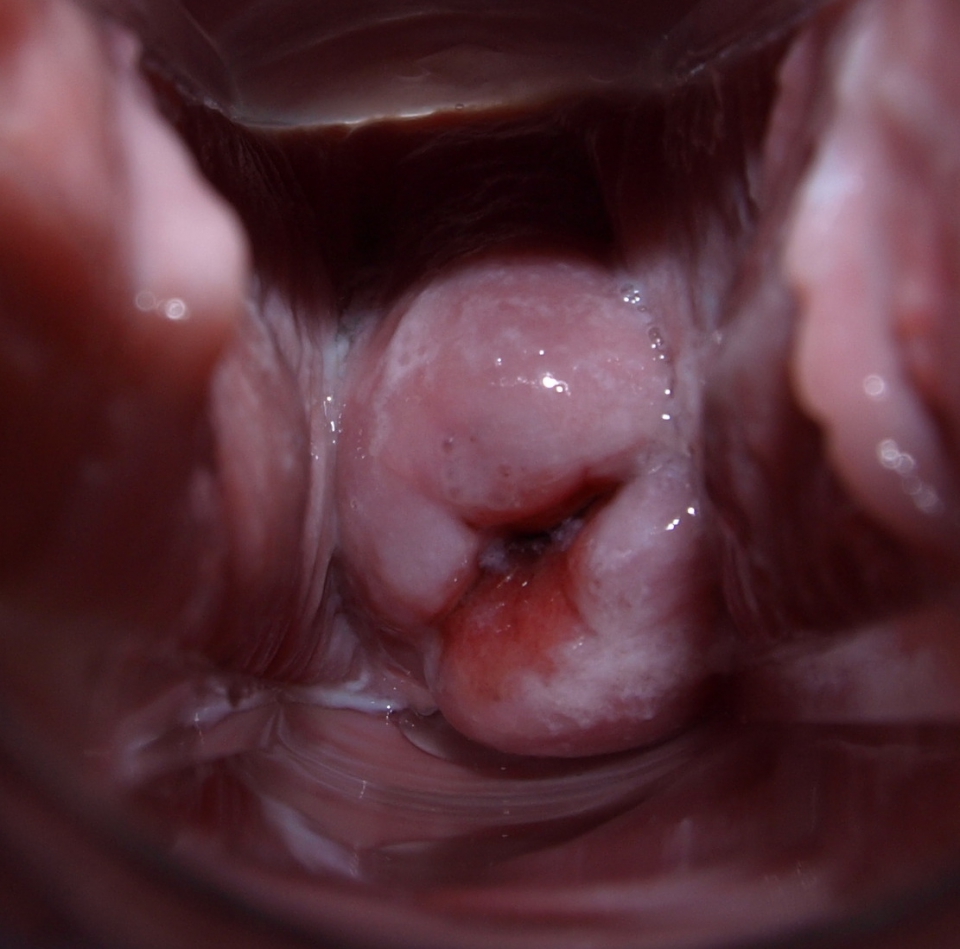 Vagina cervix full size