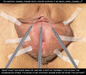 Clitoridectomy female circumcision 960X829 jpeg