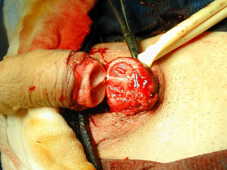 Penis head cut off full size