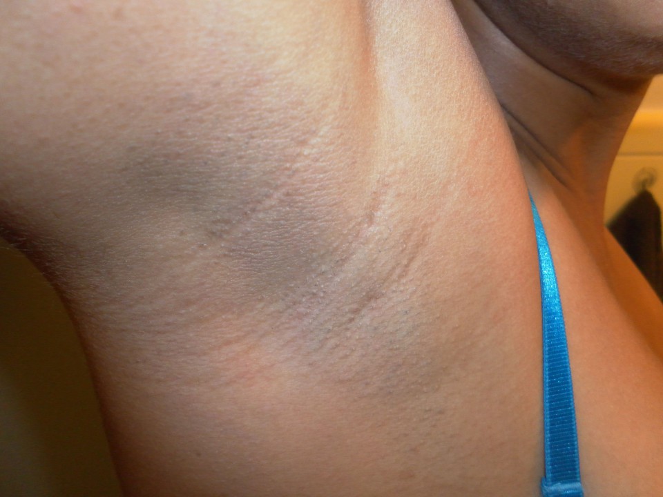 Indian female armpit stubble full size