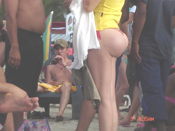 Plastic surgery butt implants full size