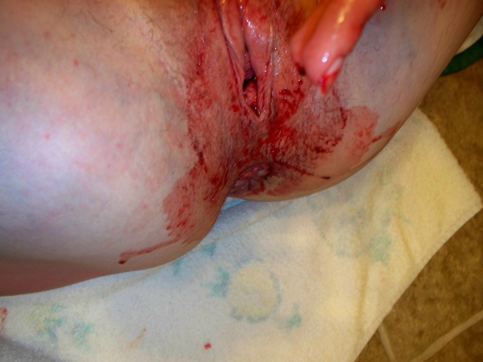 Virgin pussy bleeding on period full size