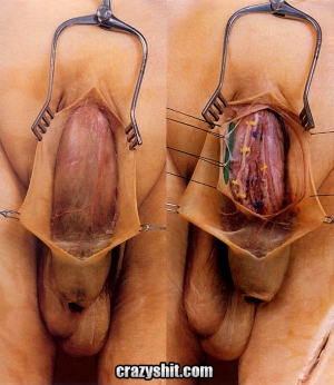 What looks like a penis without skin 590X681 jpeg