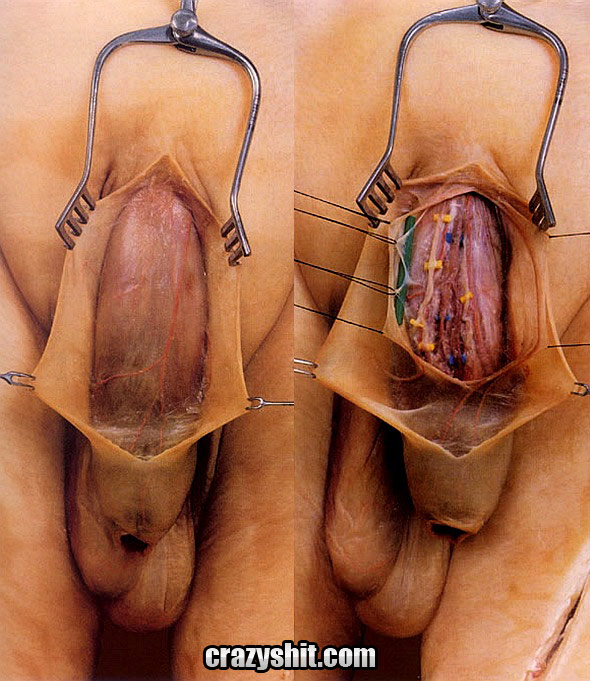 What looks like a penis without skin full size